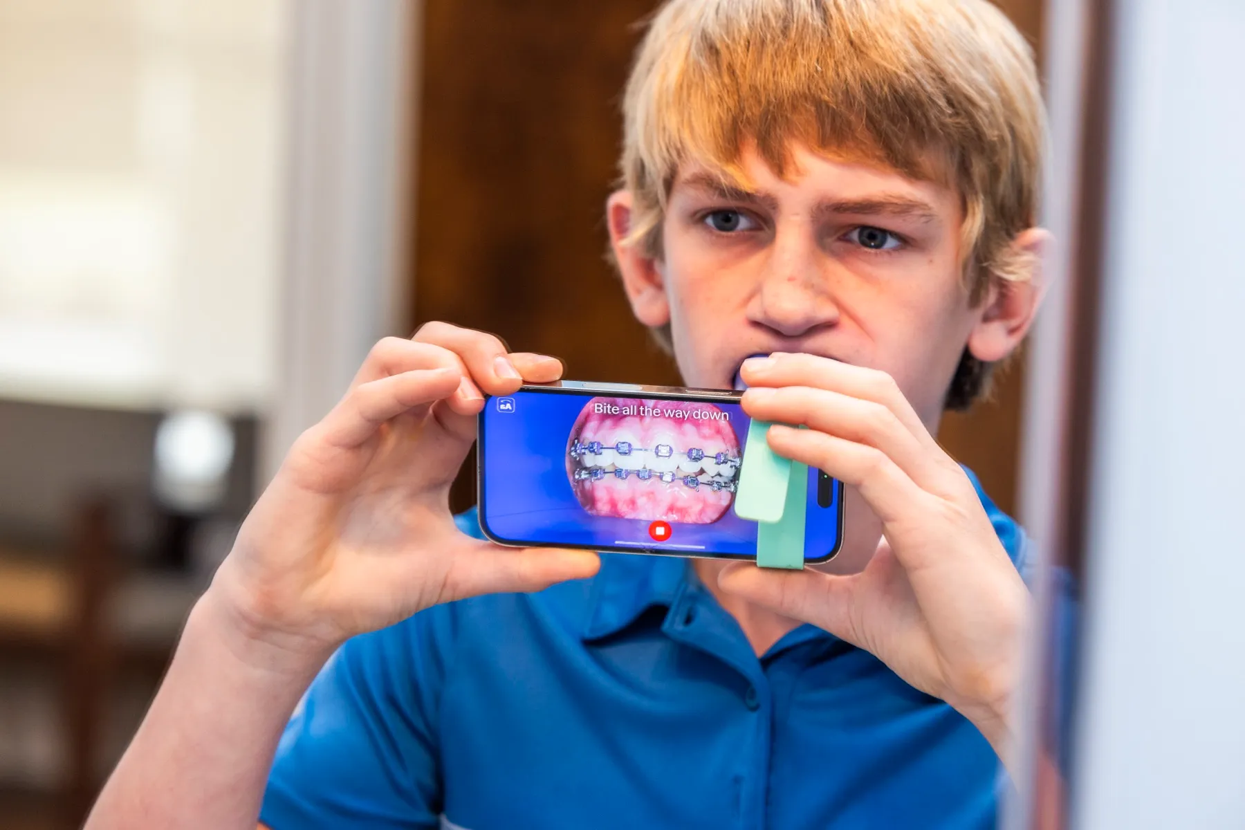 A braces patient checking in remotely through WO On The Go