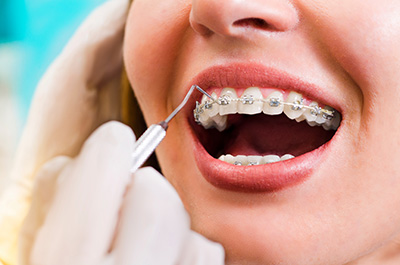wiktorski-orthodontics-braces-rochester-ny