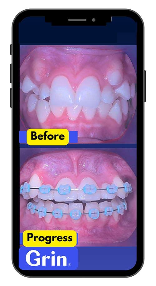 wiktorski-orthodontist-braces-dental-monitoring